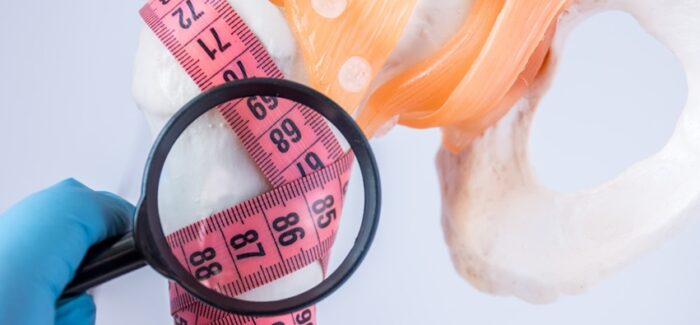 Δωρεάν μέτρηση οστικής πυκνότητας