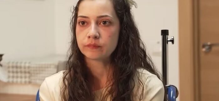 Νοέλια Καστίγιο: Οι τελευταίες στιγμές της 25χρονης που πέθανε με  ευθανασία έπειτα από 601 ημέρες αναμονής